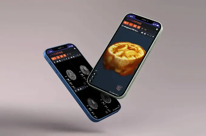 Hyperfine MRI Viewer